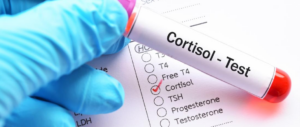 Learn More About Cortisol Near Charlotte NC