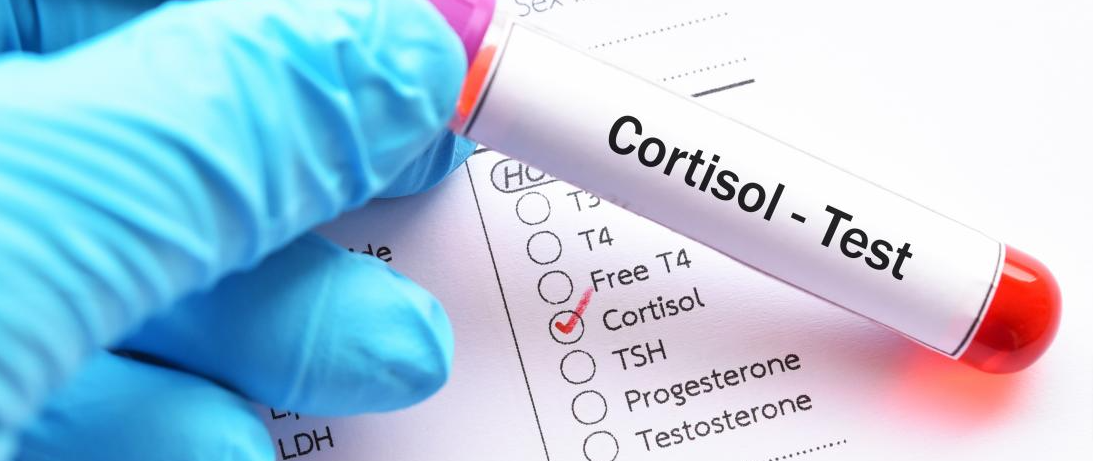 Learn More About Cortisol Near Charlotte, NC